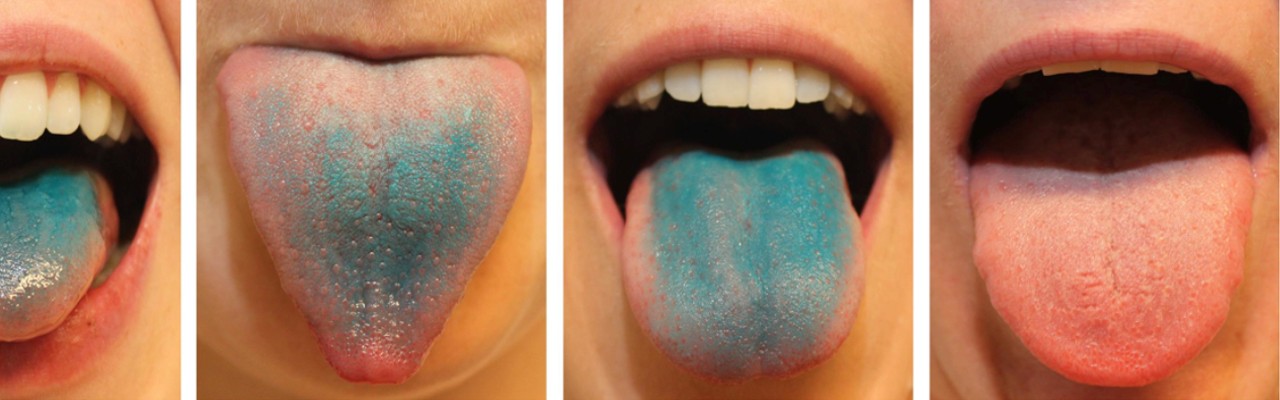 Blå tunger